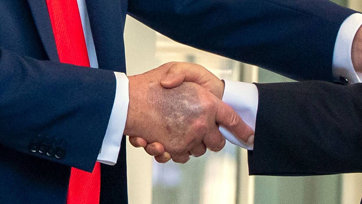 Zu sehen beim Händedruck mit dem südkoreanischen Präsidenten Lee: ein Bluterguss auf Trumps rechter Hand. | © Alex Brandon/AP/dpa
