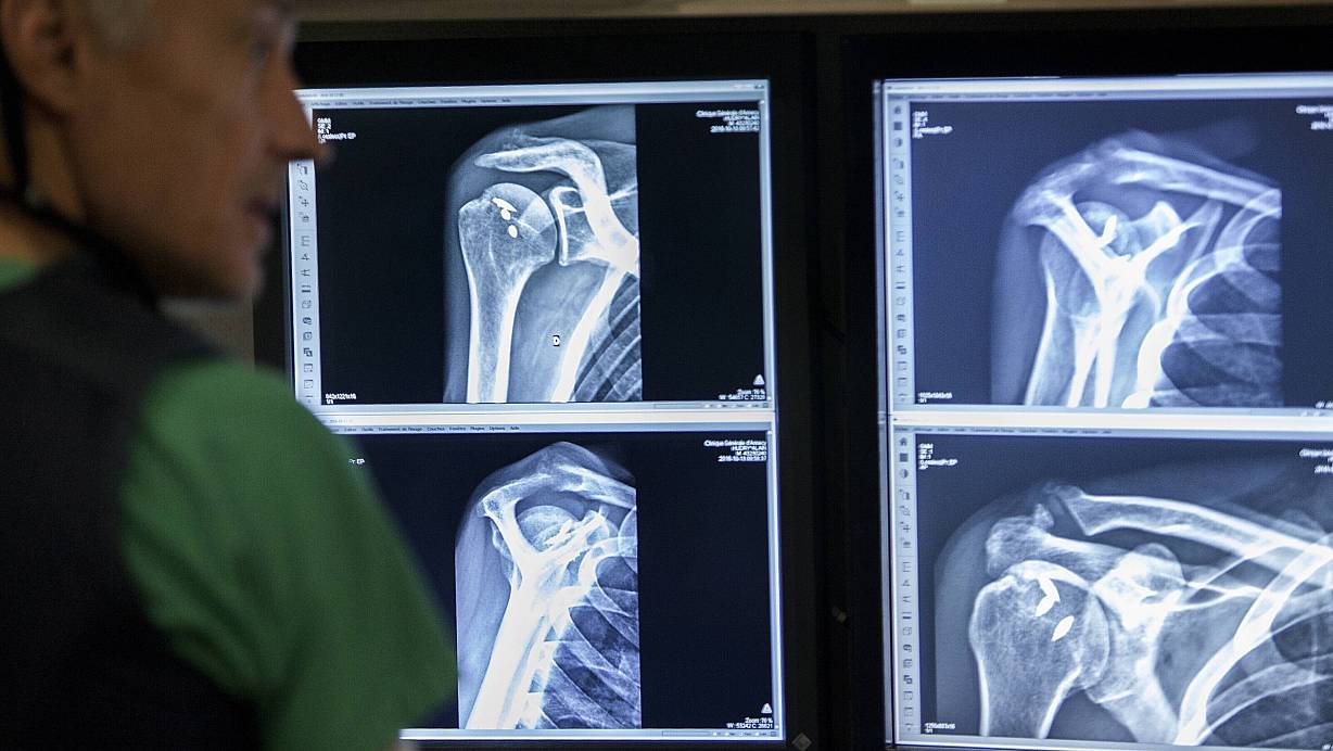 Osteoporose erhöht das Risiko für Knochenbrüche massiv. | © picture alliance / BSIP