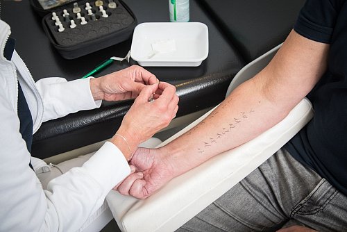 Um die Allergiesymptome gut behandeln zu können, braucht es im ersten Schritt eine Diagnostik. - © Christin Klose/dpa-tmn