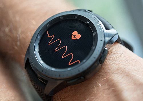 Auch Smartwatches und Wearables können dabei helfen, Herzrhythmusstörungen auf die Spur zu kommen. - © Andrea Warnecke/dpa-tmn