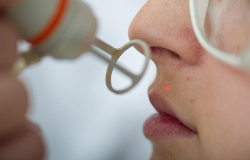 Wer sich dauerhaft von einzelnen Haaren verabschieden will, muss sie lasern lassen. Das geht aber nur bei dunklen Haaren. - © Uwe Anspach/dpa-tmn