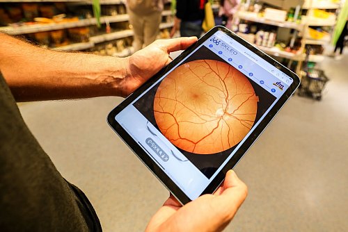 Ein Foto zeigt Details der Netzhaut. - © Christoph Reichwein/dpa