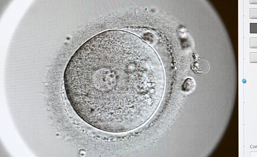 Expertinnen raten: Wer Endometriose und einen Kinderwunsch hat, sollte mit einer Kinderwunschbehandlung nicht zu lange warten, wenn es auf natürlichem Wege nicht klappt. - © Jens Kalaene/dpa/dpa-tmn