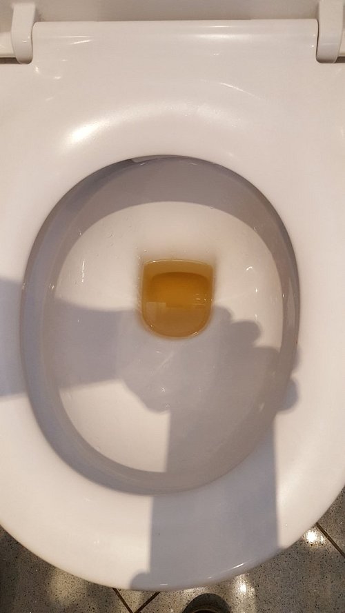 Diese Toilette wurde frisch gespült. Das Wasser kommt gelb-braun aus der Leitung. - © HK