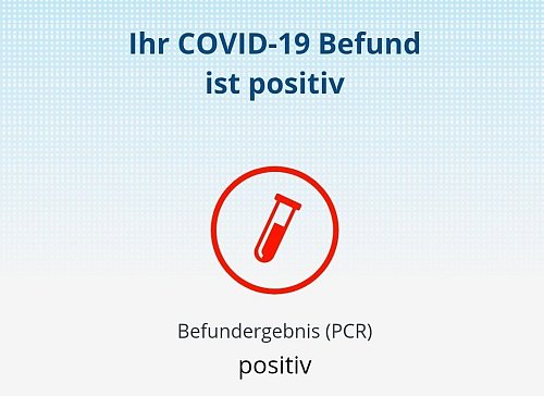 Den positiven Corona-Befund bekommt Florian Weyand auf das Handy. - © Florian Weyand